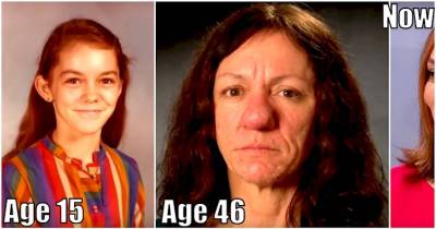 At The Age Of 15, Her Nose Just Started To Grow And Grow Until It Was A Gigantic Problem. Look At Her Now After Undergoing Surgery.