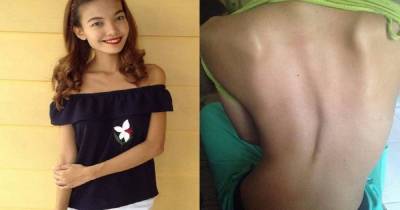 She Was Always Thin Despite Eating More Than An Average Person But Her Condition Is No Joke!