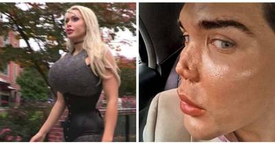 Outrageous And Hilarious &lsquo;Botched&rsquo; Stories