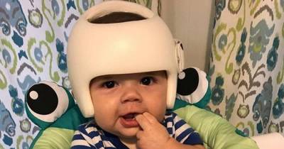 4-Year-Old Has To Wear A Helmet For His Medical Condition So The Whole Family Decides To Wear One In Support