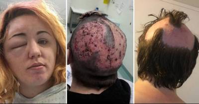 Horrifying Experience Shows The Dangers Of Bleaching Your Hair At Home