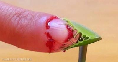 Deadly Plants You&rsquo;d Better Stay Away From
