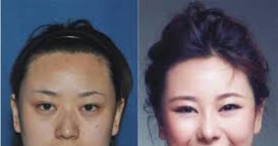 Woman Gets Plastic Surgery To Escape $3.7 Million Debt And The Story Only Gets Worse From There