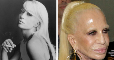Celebrities Who Have Aged Terribly