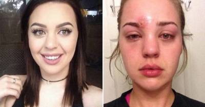 This Girl Almost Died From Not Washing Her Makeup Brushes