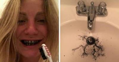 Woman Brushes Teeth With Charcoal For 7 Days And Here&rsquo;s The Outcome