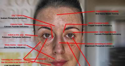 Signs Your Body Is Full Of Toxic Heavy Metals And How To Detoxify