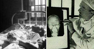 15 Of The Stupidest Treatments In History