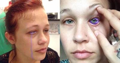 Model Warns Others On Facebook After Eye Tattoo Goes Seriously Wrong