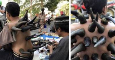 Indonesian Street Therapists Use Buffalo Horns To Heal People