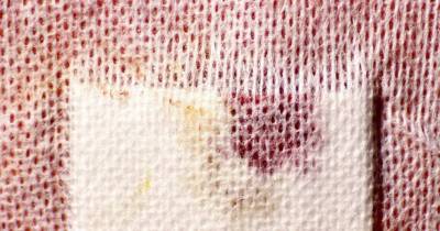 Researchers Have Discovered How Our Cells Heal Wounds