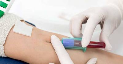 Things Your Doctor Won&rsquo;t Tell You About Your Blood Test