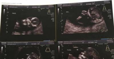 Mum Shares Ultrasound So Terrifying People Say Her Baby Will Be &lsquo;Pure Evil&rsquo;