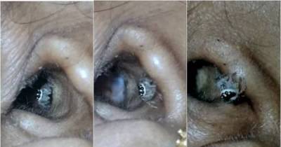 This Woman Thought She Just Had A Terrible Headache. What She Actually Had Will Give You Nightmares.