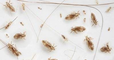 How To Get Rid Of Head Lice Naturally