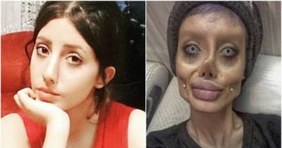 Doctors' Ethics Are Now Being Questioned After He Performed 50 Surgeries On An Iranian Teen So She Could Look Like Angelina Jolie