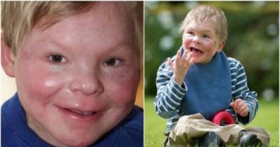 This 13 Year Old Is Trapped In A Toddler's Body Due To A Strange Condition