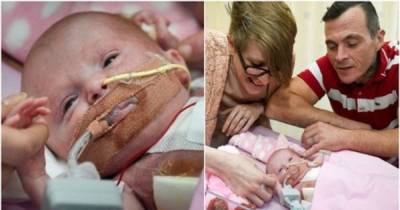 Baby Is Born With Her Heart On The Outside Of Her Body And Survives