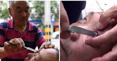 This Man Underwent A Bizarre Eye Shaving Procedure To Improve His Eyesight