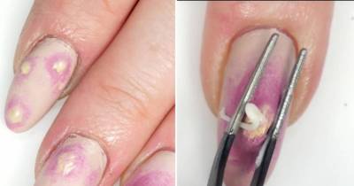 Pimple Popping Nails Are Trending And They'll Make You Want To Vomit