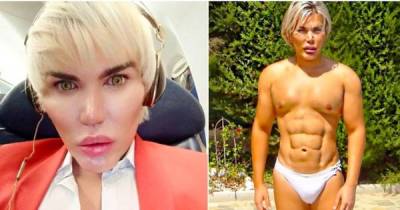 You Won't Believe How This Human Ken Doll Looked Before His Drastic Surgeries.