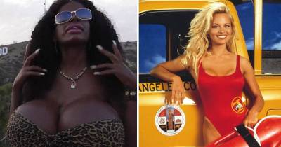 The White Model Who Turned Herself 'Black' Now Wants To Be A Baywatch Babe