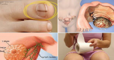 Twelve Signs Of Cancer That Most Women Ignore
