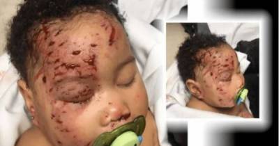 Infant Girl Is Mauled In Her Sleep By A Raccoon