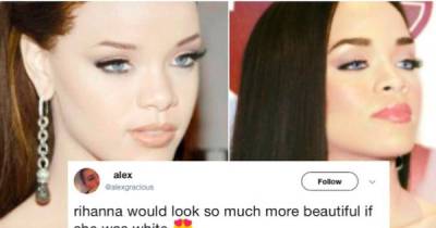Rihanna Claps Back At 'Fan' That Said She Was 'More Beautiful' After She Was Whitewashed.