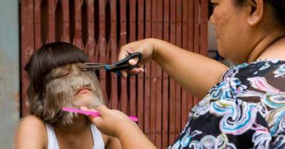World&rsquo;s Hairiest Girl Found The Love Of Her Life After Shaving Her Face