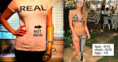 10 Amazing Amputees Who Spend Their Lives Looking On The Bright Side Of Things.