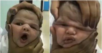 Nurses Fired For Recording A Video While Squishing A Newborn Baby's Face