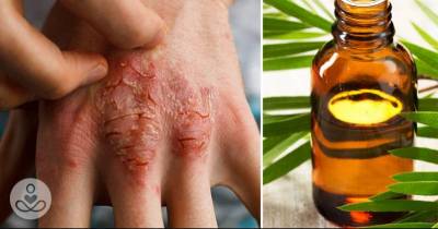 Essential Oils For Healing Any Type Of Skin Condition And How To Use Them