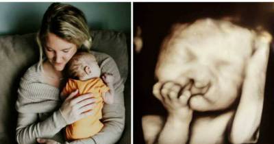 Parents That Refuse To Abort Baby, Get A Note About Baby's Looks That Makes Mom Sob