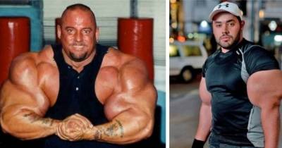 7 Crazy Looking Bodybuilders That Really Need To Lay Off The Roids And Injections!