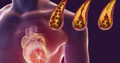 Foods That You Should Eat Daily To Unclog Arteries