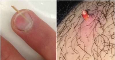 16 Pictures That Will Turn Your Stomach And Keep You Up At Night