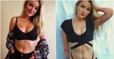 She Lost One Hand At Birth, And The Other Is Deformed, But She Has Totally Owned Her Entire Body
