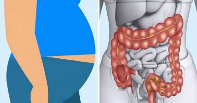 Sign And Symptoms Your Body Is Not Digesting Meat Properly