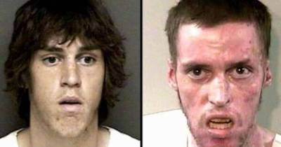 Before And After Drug Use Pictures That Will Make You Want To Stay Drug Free