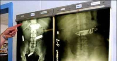 Crazy X-Rays That You Have To See To Believe