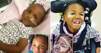 Five-Year-Old Girl Beats Deadly Meningitis But Her Condition Leaves Her With Vitiligo