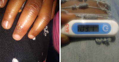 4 Year Old's Girl's Finger Begins To Bleed And Swell, The Girl Later Reveals Shocking Details To Her Mom About What Her Teacher Did To Her At School