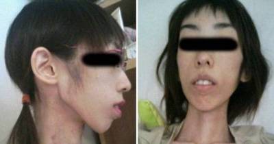Heartwrenching Picture Shows Japnese Women Physically Abused By Her Grandfather