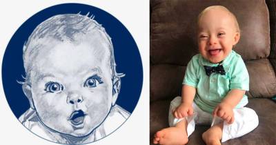 One-Year-Old Lucas Is The First Gerber Baby With Down Syndrome