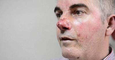 Heroic Dad Left Bloodied After Fighting Off Machete-Wielding Thieves To Protect His Son