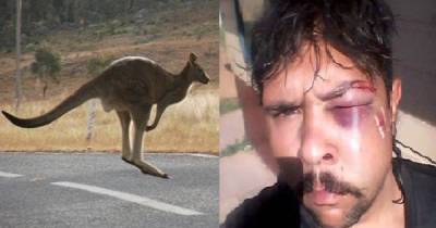 Hunter Got More Than He Bargained For After Kangaroo Fought Back