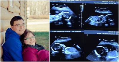 Pregnant Mom Gets Routine Ultrasound, Almost Passes Out When Nurse Tells Her, Her Pregnancy Is 1 In 15 Million