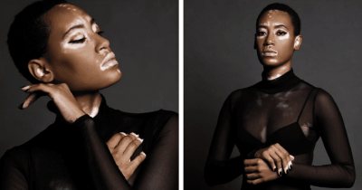 Covergirl Features A Model With Vitiligo In Their New Beauty Campaign Ad For The First Time Ever