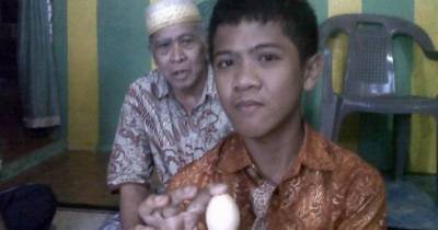 14-Year-Old Boy Claims He Laid Two Dozen Eggs In Two Years